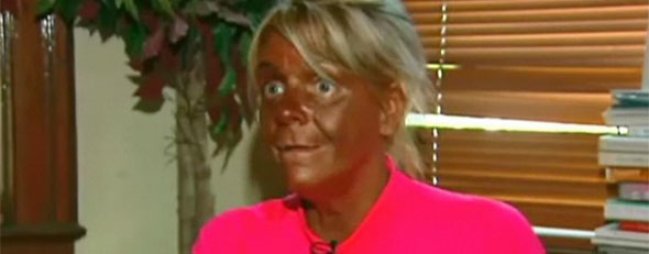 tanning2_uni.jpg