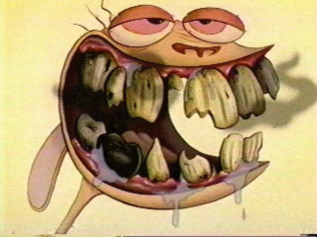 rotten-teeth-6.jpg