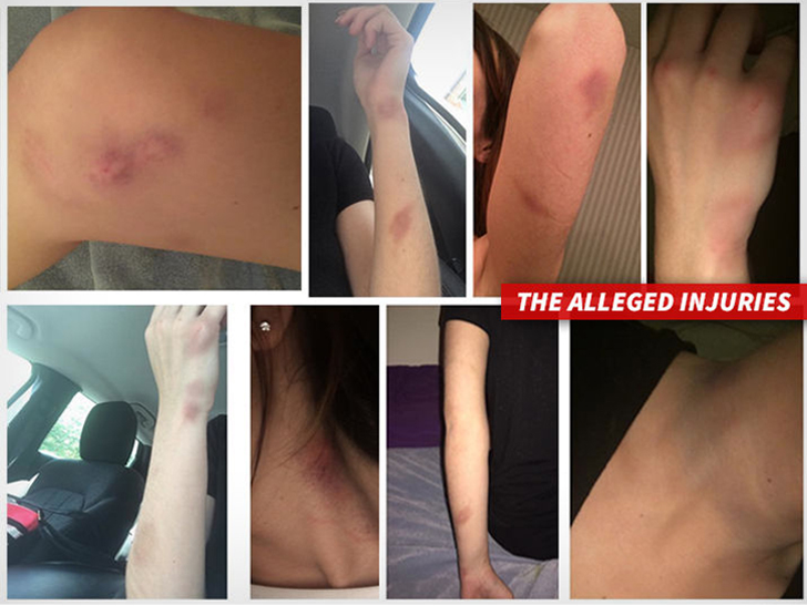 0811-ezekiel-elliott-girlfriend-alleged-injuries-instagram-3.jpg