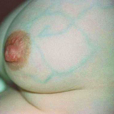 Veins%20006.jpg