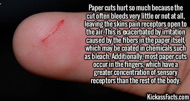 2645-Papercuts.jpg