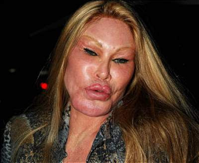 wildenstein.jpg