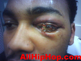 HOUSTONs+eye.jpg