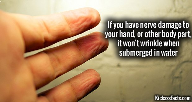938-Wet-Wrinkly-Fingers-Test.jpg