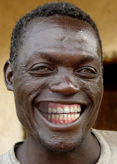 teeth.jpg